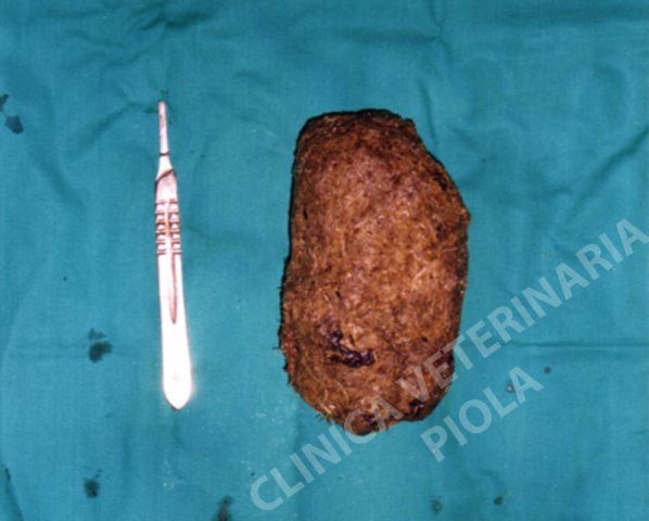 Fitobezoario